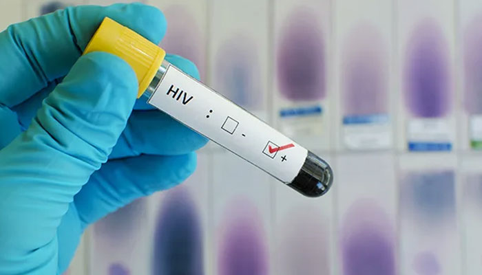 The number of registered HIV patients increased to 19 thousand 766 —File photo