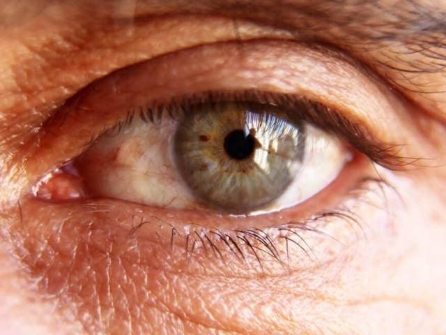 Frequent hypoglycemia in diabetic patients is harmful for vision Frequent low blood sugar levels in diabetics can further damage the eye. Photo: File