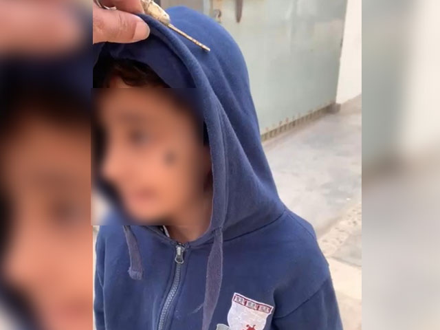 In a private school in Karachi, a child was slapped with 'kalk' on his mouth for speaking Urdu