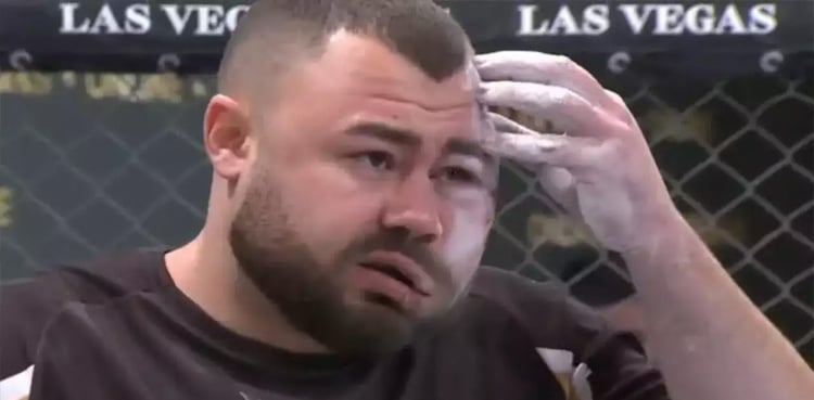 The opponent's slaps disfigured the player, the video went viral slap