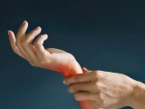 A drug called Telrozole can be an effective treatment for arthritis of the hands.  Photo: File 