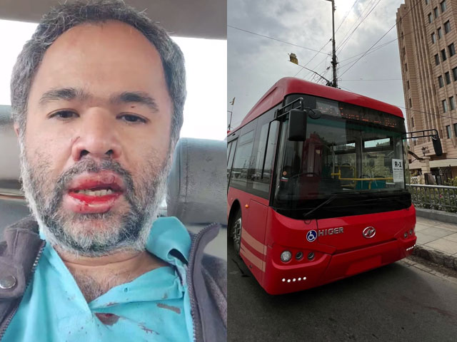 A case of violence against a passenger doctor in a red line bus has been registered, the driver and conductor have been suspended