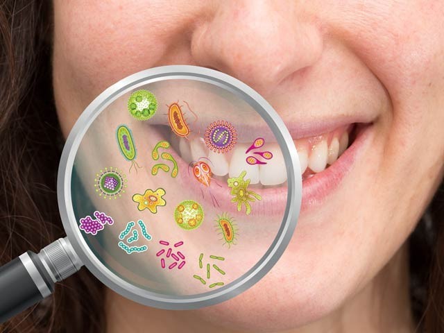 Oral health can affect the brain Experts have said that mouth disorders can increase the risk of developing mental disorders. Photo: File