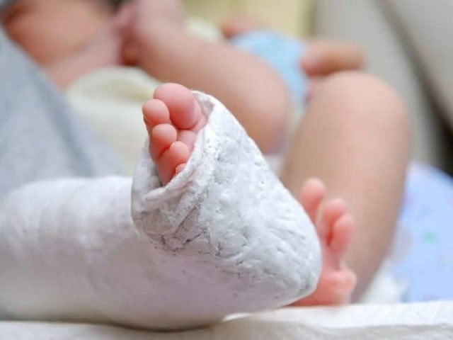 A one-and-a-half-year-old child was on a ventilator for 7 days in a life-and-death struggle;  Photo: File 