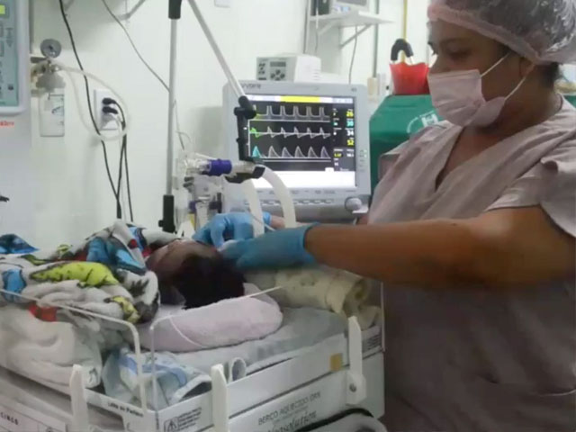 Baby girl with 6 cm long tail successfully operated in Brazil