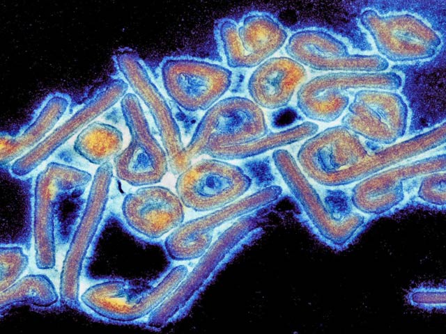 Marburg Virus Deaths Confirmed in Africa