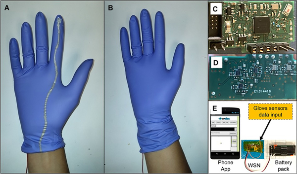 Pressure gloves that can reduce stillbirths