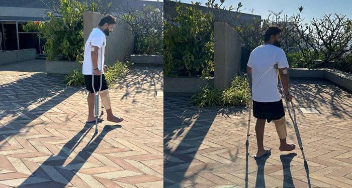Rishabh Pant started walking with crutches
