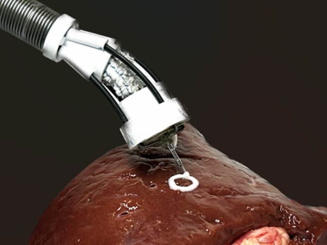 A bioprinter that prints cells in the human body A flexible robot created by experts from the University of New South Wales can go into the human body and print cells or biological components on any organ or tissue. Photo: Courtesy of Newatlas