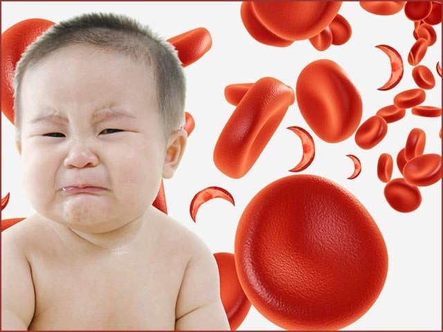 American and Ghanaian experts have created a smartphone app that can detect anemia in children from images of eyes and lips.  Photo: File 