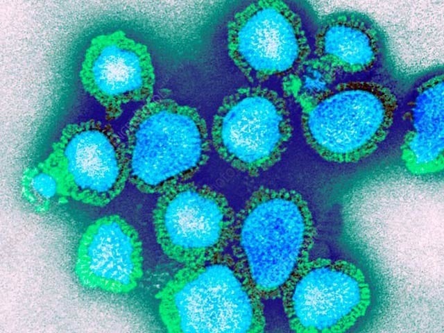 Two deaths have been confirmed in India due to a slightly new type of H3N2 virus.  Photo: Science Photo Library 