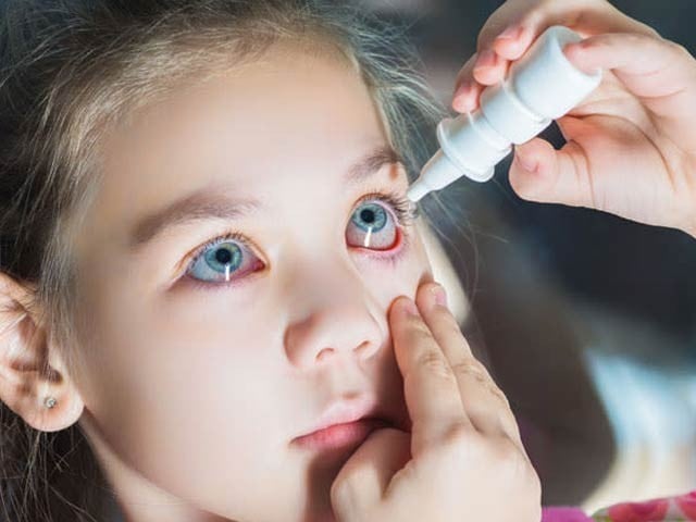 This medicine can slow the rate of vision loss in children Atropine 0.05% concentrated eye drops can prevent nearsightedness in children. Photo: File