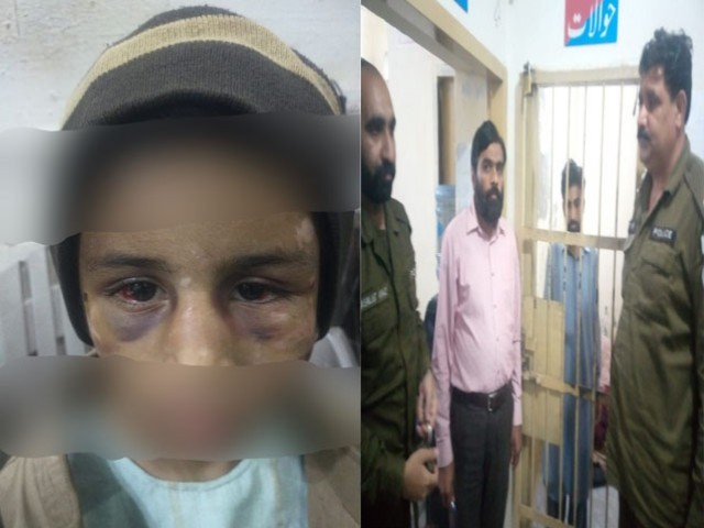 In Rawalpindi, the stepfather tortured a young girl, the accused was arrested after the video went viral Photo: Express