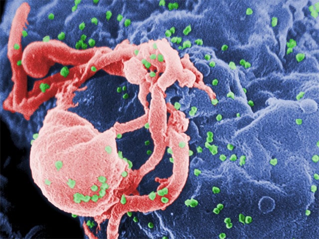 Revealing the existence of a secret shelter of HIV in the immune system