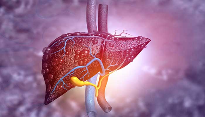 World Liver Day, what signs should not be ignored? World Liver Day, what signs should not be ignored?