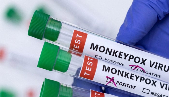 Pakistan's first case of monkeypox, a man expelled from Saudi Arabia showed symptoms Pakistan's first case of monkeypox, a man expelled from Saudi Arabia showed symptoms