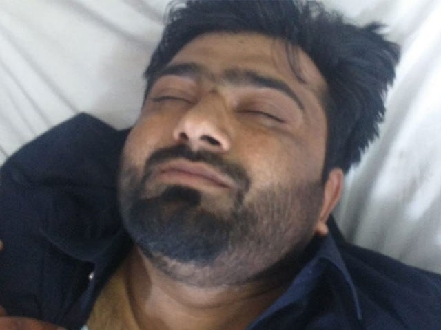 The injured police officer Imran was immediately shifted to the hospital, officials (Photo: Express)