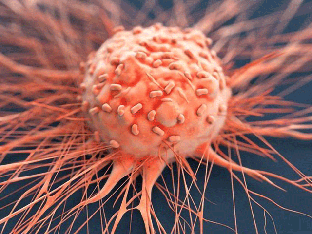 Genetically engineered bacteria succeed in eradicating cancer Skin cancer has been eradicated by genetically modifying a skin bacteria. Photo: File
