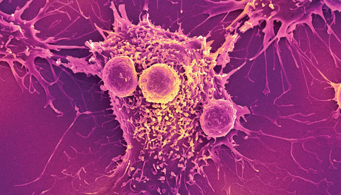 Cancer: Modern Approaches to Treatment