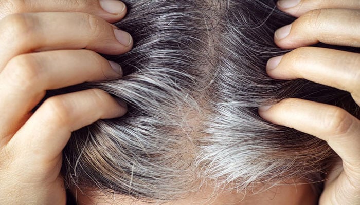 Scientists explained the reason for the gray hair