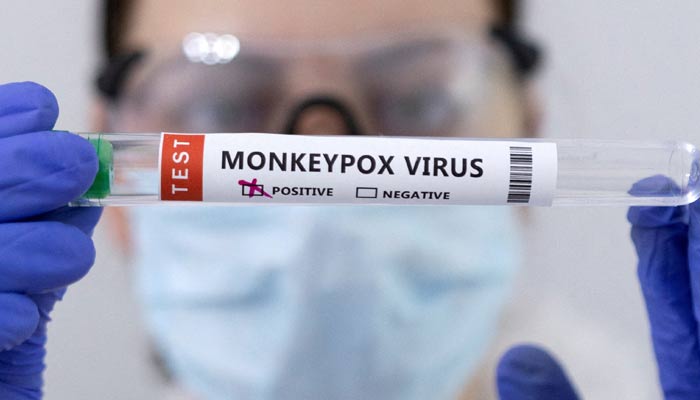 The arrival of the first female passenger suspected of monkeypox in Pakistan at Karachi Airport The arrival of the first female passenger suspected of monkeypox in Pakistan at Karachi Airport
