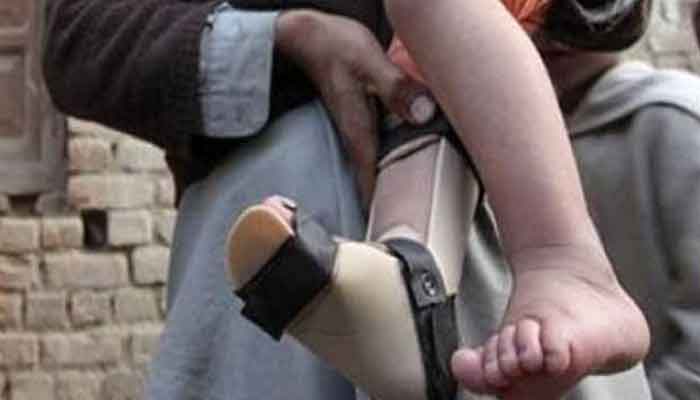 The first case of polio was reported in Afghanistan this year File photo
