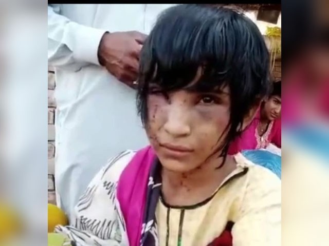 Child Protection Bureau Failed; Horrific violence on a young domestic worker in Punjab —Photo: Express News