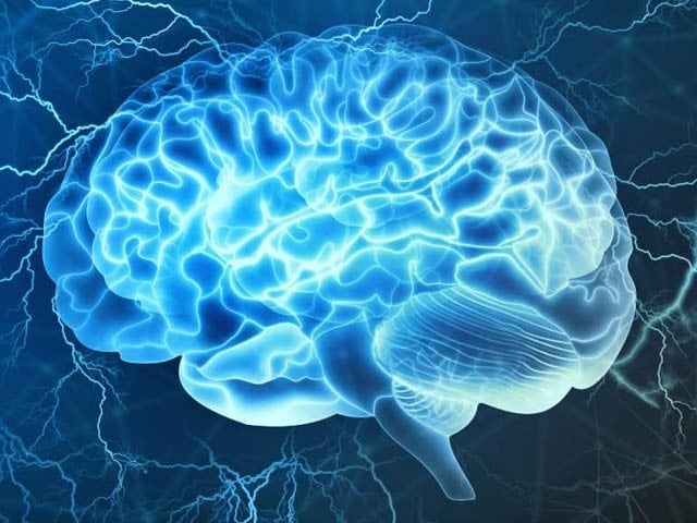 Giving mild electrical activity to the brain can improve its function.  Photo: File 