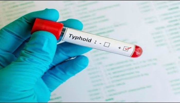 Confirmation of cases of drug resistance typhoid in Karachi