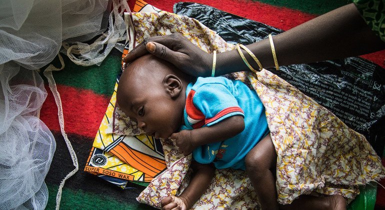 Horn of Africa: Over 7 million children under the age of 5 remain malnourished