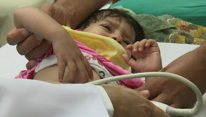 Increase in rate of measles infected children in Rawalpindi