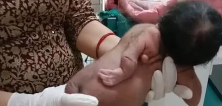 Strange baby born in India