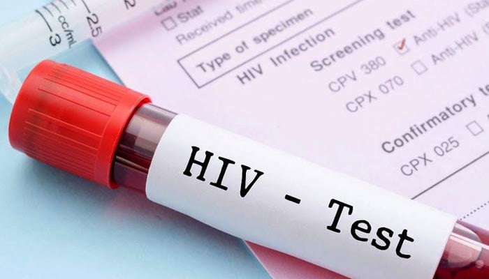 Islamabad, non-treatment of HIV infected people in private hospitals revealed Islamabad, non-treatment of HIV infected people in private hospitals revealed
