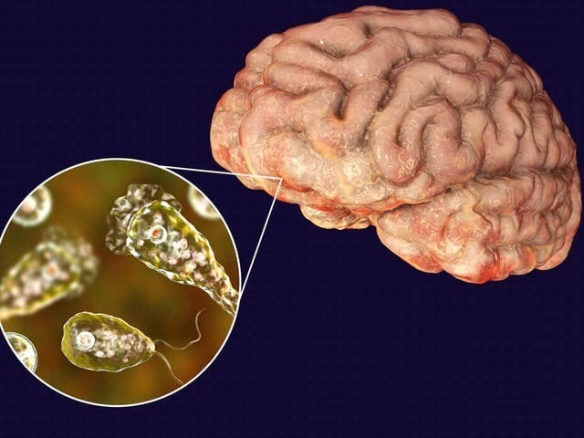 A nigella bacterium attack can be 95% fatal, Pakistan Medical Association Pakistan Medical Association has also provided preventive measures to prevent Nigella infection. Photo: File