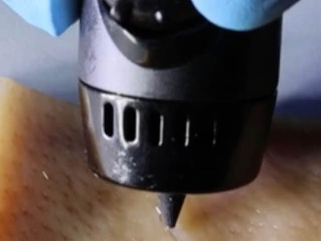 Chinese experts have created a thin 3D pen that delivers a hydrogel that quickly heals wounds.  Photo: Nanjing University 