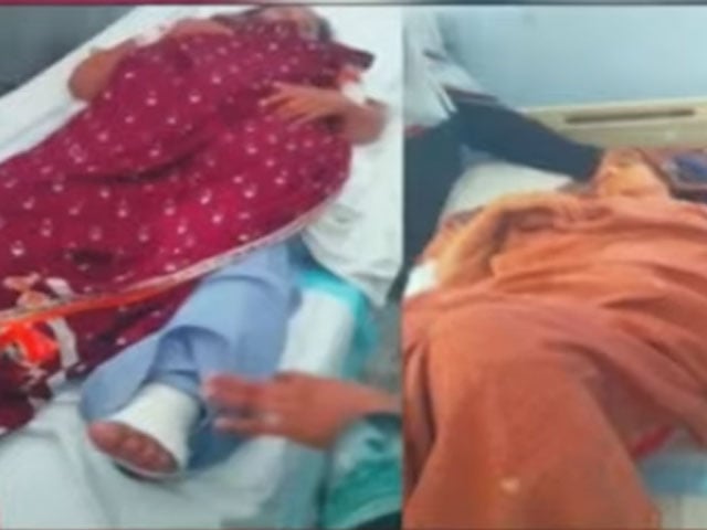 Faisalabad: Operation of gall bladder patient's leg and leg gall bladder in a private hospital