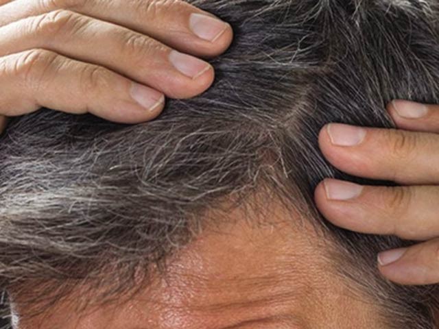 Karachi; The accused escaped after snatching the bike in 15 seconds, the footage came to light According to some researchers, gray hair has genetic causes. Photo: File