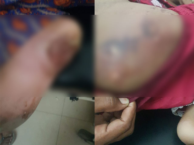 Stepmother became executioner in Karachi, humane violence against young girls