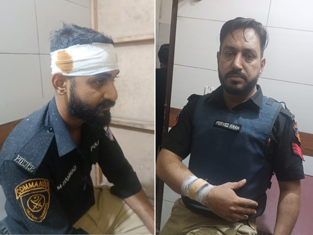 Photo of injured police officers (Photo: Express)