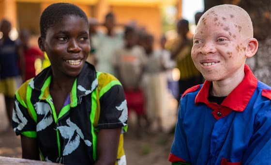 ‘Inclusion is strength’ stresses UN, marking Albinism Awareness Day