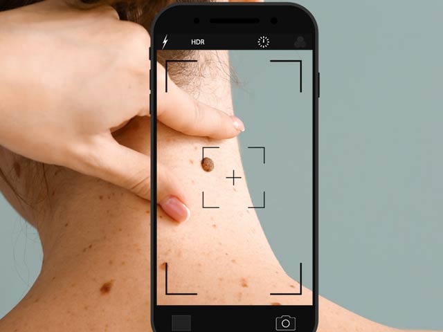 Now it is possible to identify skin diseases thanks to Google Lens