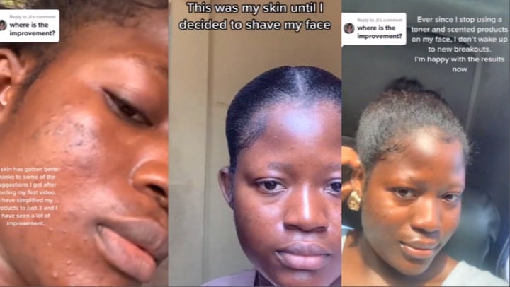 Tik Tok's beauty tip took the woman to the hospital