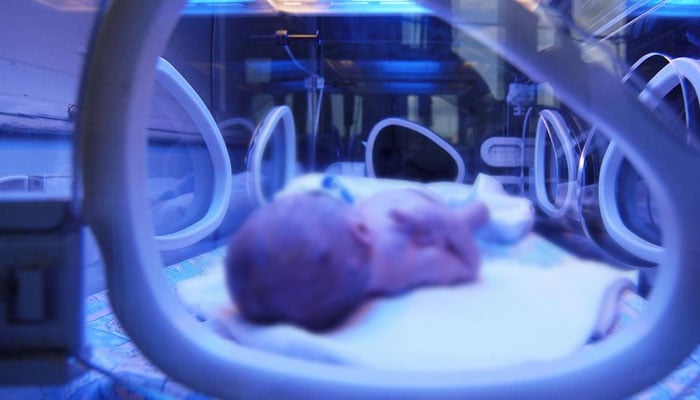 The legs of a newborn girl were burnt in a private hospital Iconic photo