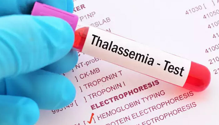 Increase in rate of thalassemia patients in Khyber Pakhtunkhwa —File photo