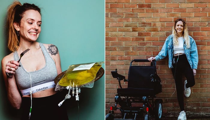 British female chef who has been unable to eat by herself for 8 years Photo courtesy of Instagram