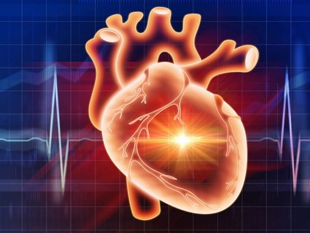 Heat waves and air pollution double the incidence of heart attacks Heat waves and air pollution can double the incidence of fatal heart attacks. Photo: File