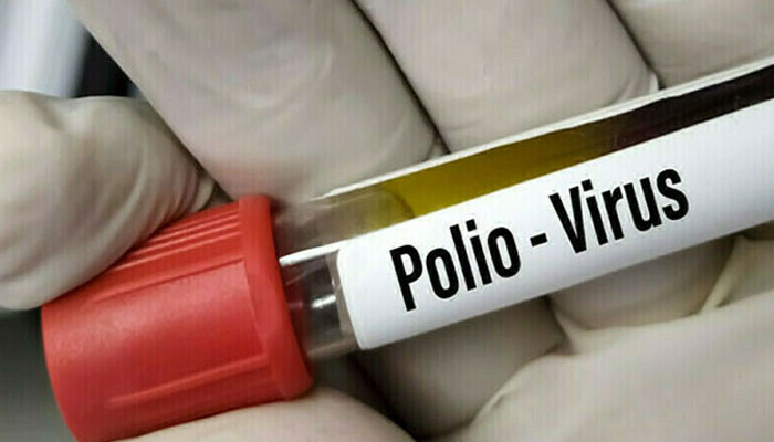 Confirmation of poliovirus in environmental samples Iconic photo