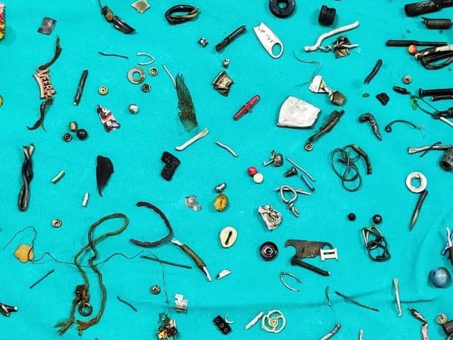 Among the items removed from the stomach were nut bolts, headphones and buttons, etc.: Photo: Social Media