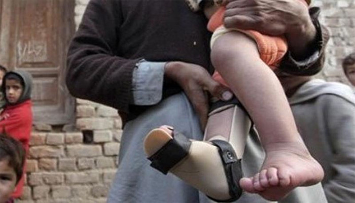 Another child disabled by polio virus