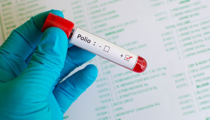 Confirmation of polio virus in environmental samples of different cities